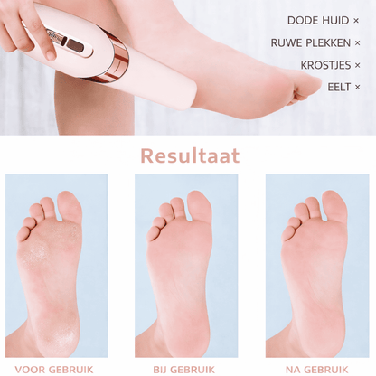 PediCare™ | Gemakkelijk Thuis Je Voeten Verzorgen.